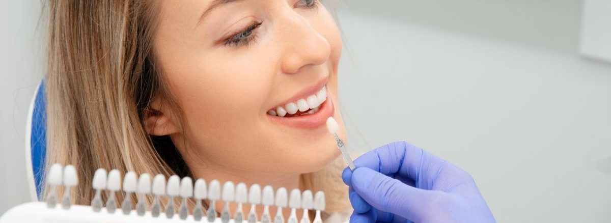 Laminate veneer diş kaplama fiyatları