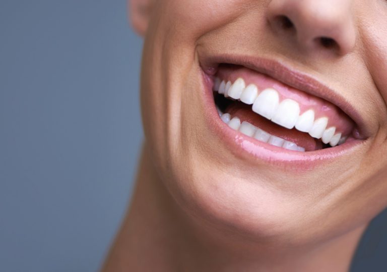 طراحی لبخند در استانبول
