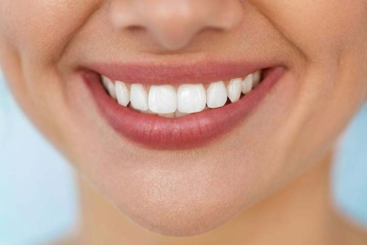طراحی لبخند در استانبول