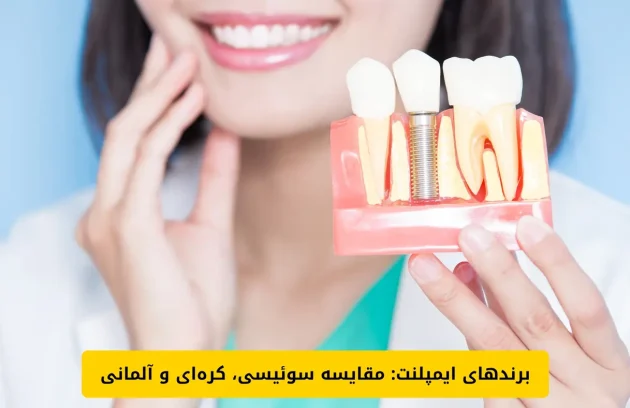 برندهای ایمپلنت مقایسه سوئیسی، کره‌ای و آلمانی